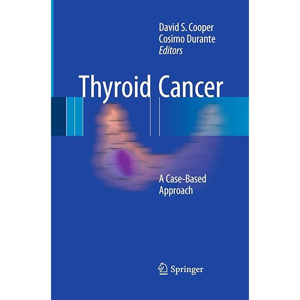 Thyroid Cancer: A Comprehensive Guide to Clinical Management